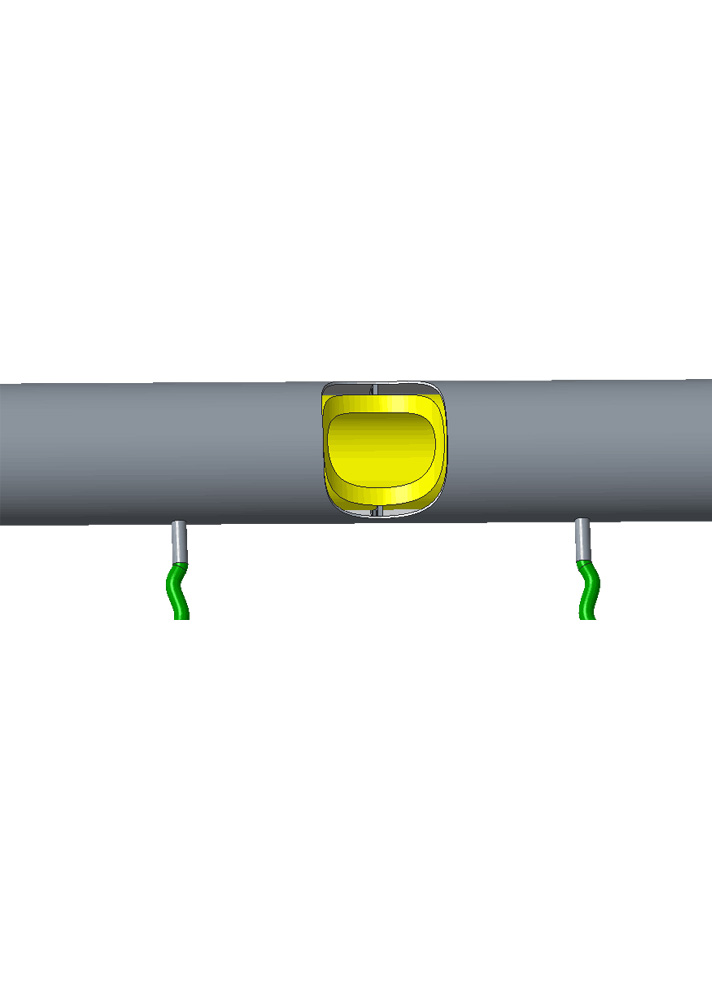 Key components and control of feeding system